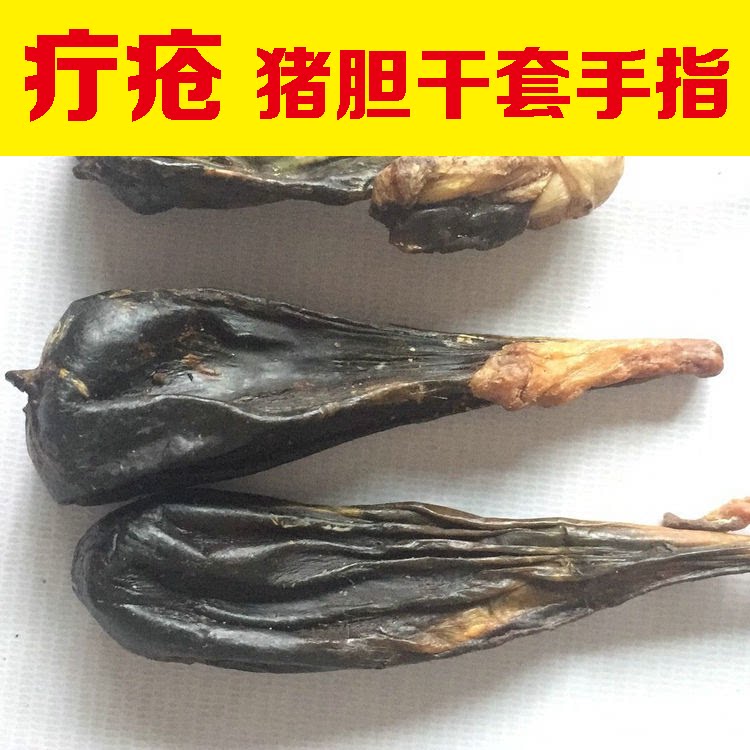 【疔疮 猪胆干套手指】 猪胆干 羊毛疔 苦胆干猪胆囊干套于手指疔