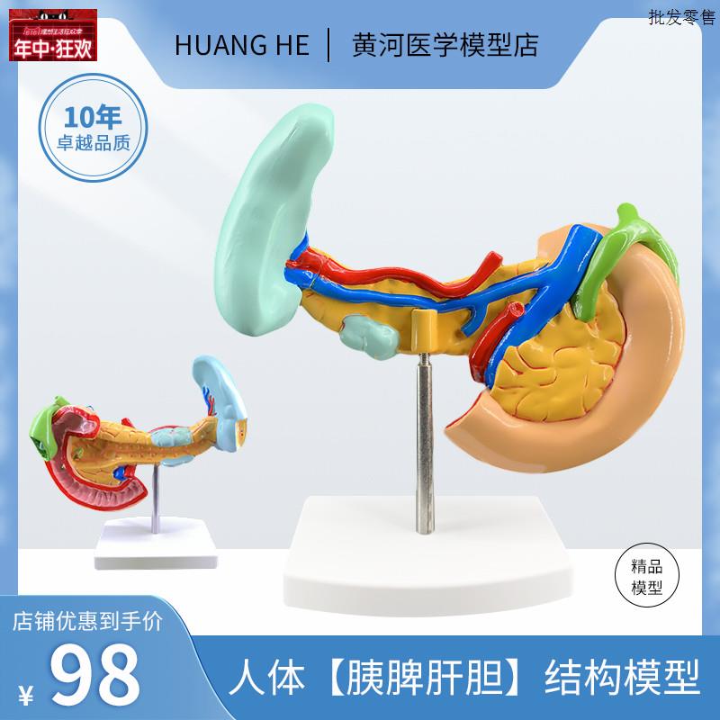 病变胰脾肝胆十二P指肠模型病理标本胰脾肝胆人体器官解剖教学模