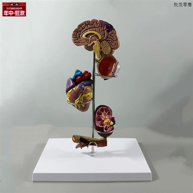 糖尿生理功能模型病理紊乱内分w泌系统器官足眼底视网膜脑心血管