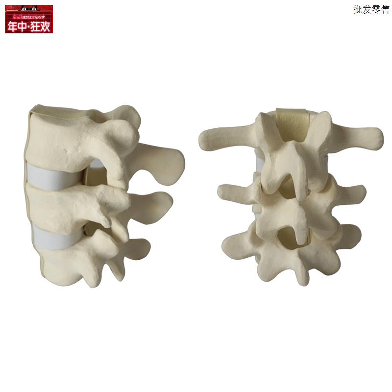 腰椎手术演示模型n骨科仿真练习用骨骨科Sawbone骨教学
