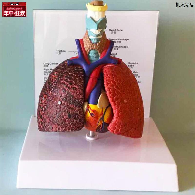 喉心肺肺段肺脏病态健康比较解剖医用医学模型胸外科支x气管树包