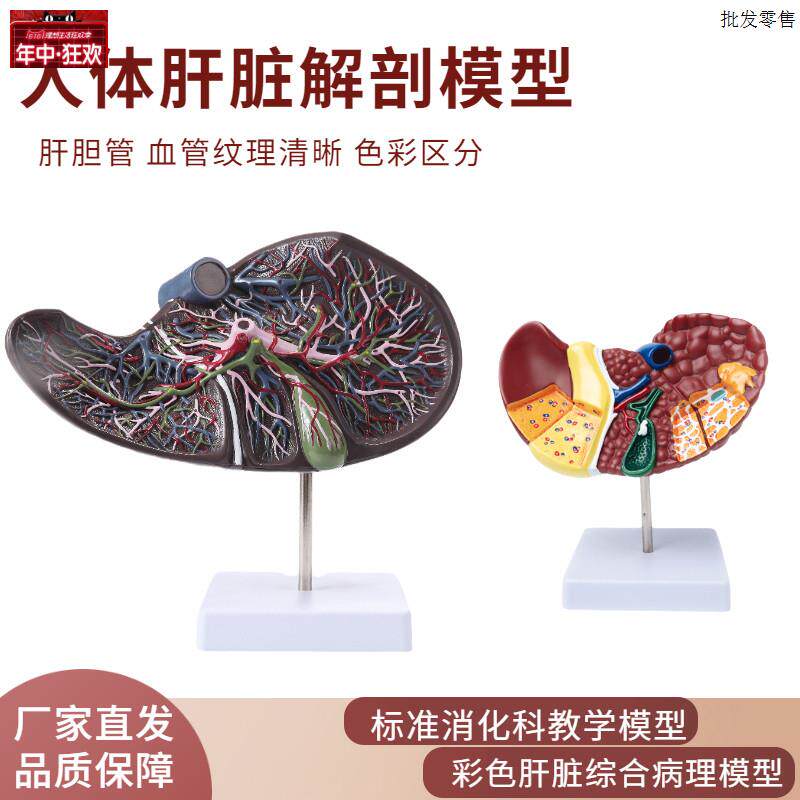 仿真肝脏模型肝解剖模型肝胆胰脾十二指肠病变肝T胆胰胆囊消化内
