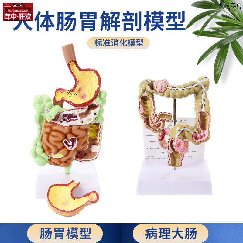 人体肠胃W模型结肠大肠直肠模型医院校用教学演示优质器官解剖模