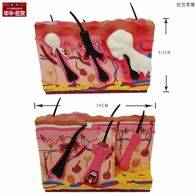皮肤皮炎湿疹皮癣疱疹模型痘痘痤皮肤病态解剖模S型医学培训展示
