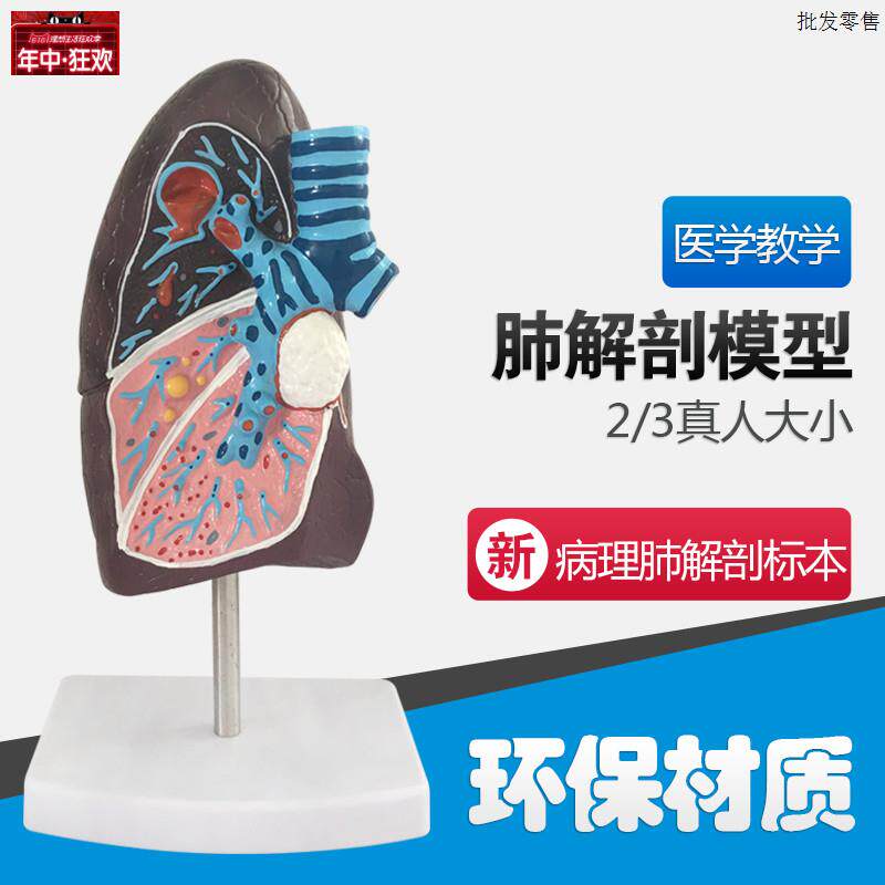 人体肺解剖m模型,肺部模型,病态肺模型,人体病变肺解剖模型内脏