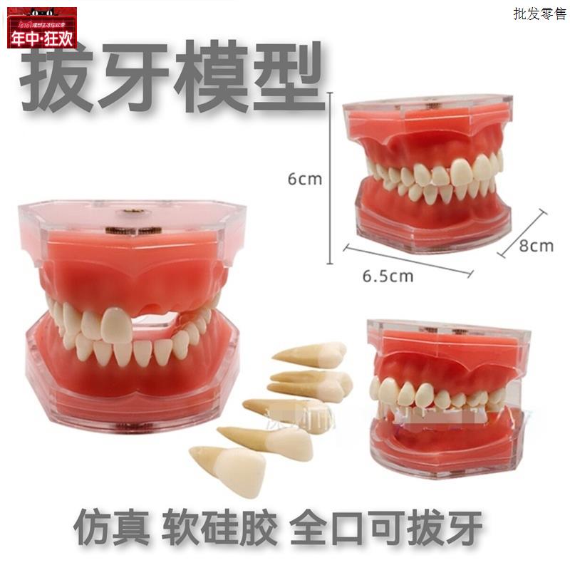 牙科模型口腔教学可I拔牙软牙龈树脂牙科医患沟通成人练习牙带牙