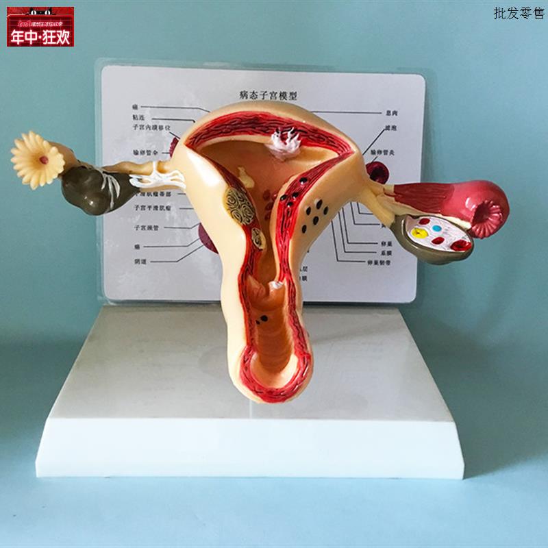 子宫模型生殖器女性器官解剖人体教B学教仪医用教具包邮厂家直销