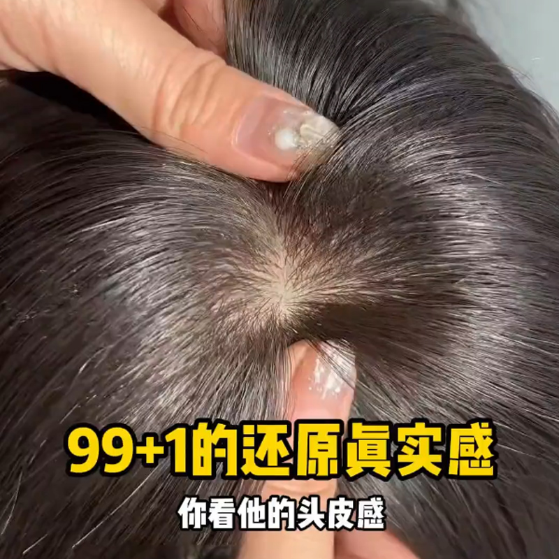 俏希仿真头皮头顶假发片逼真自然
