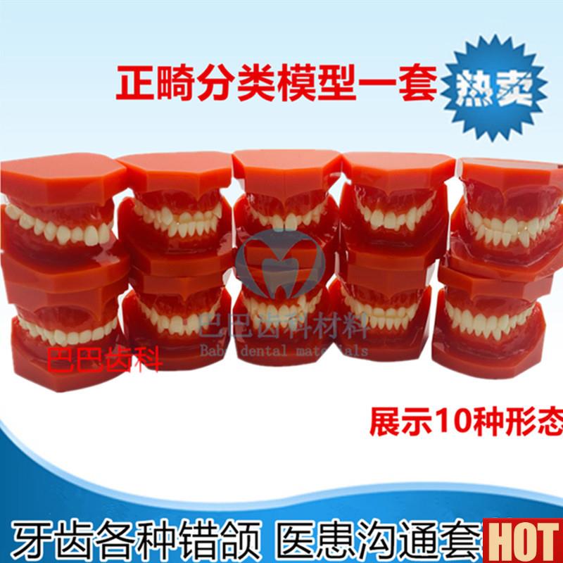 科正畸牙w齿错颌模型 地包天 天包地 龅牙正畸分类展示模型一套