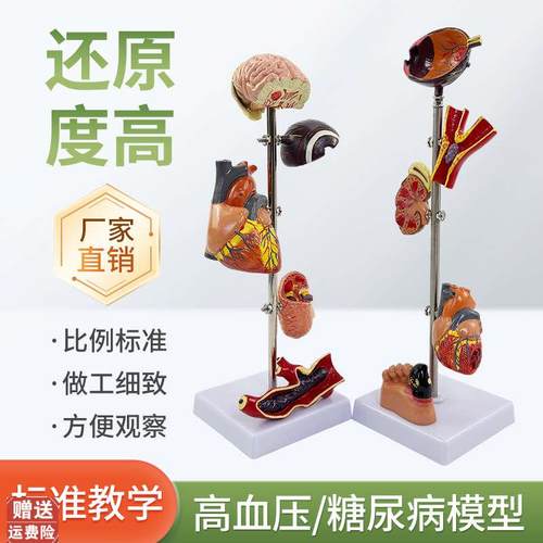 高/血压模型糖尿/病变内脏模型病态血压病理脑眼心.脏肾脏血管