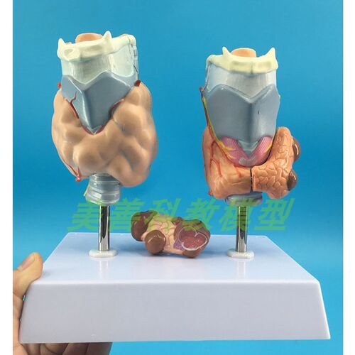 病理甲状腺模型 喉头解剖模型 甲状腺I留 甲状线囊中 甲状线病