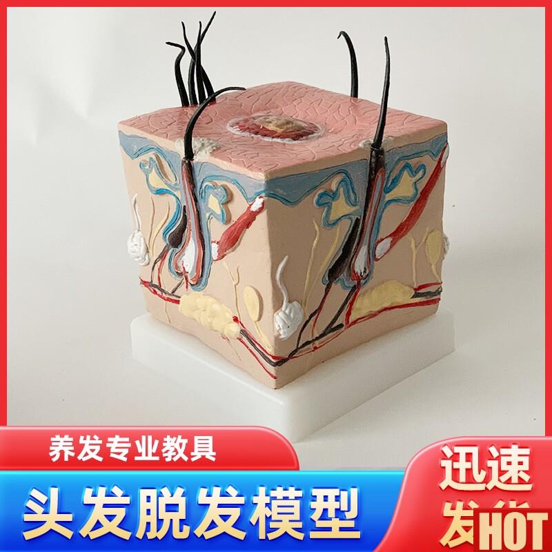 体毛发脱发模型头发头皮发炎毛c细血管毛囊收缩教学教具演示模型