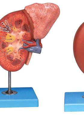 肾脏与肾上腺放大t模型/解剖模型A14006
