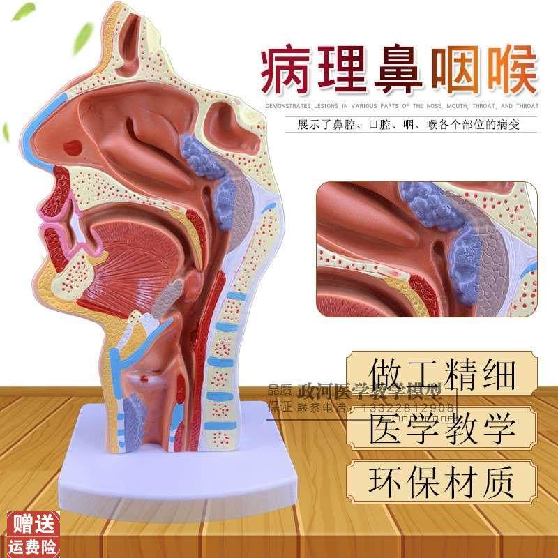 病态鼻咽喉模型医用鼻腔解剖呼吸道模型喉咙带肌肉U血管神经甲状,玩具/童车/益智/积木/模型,其他模型玩具,淘宝优惠券,粉丝福利购,淘宝优惠卷