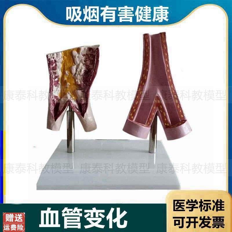血管模型病理正常吸烟有害脏器心脏F口腔牙齿妊娠胎儿膀胱气管肺