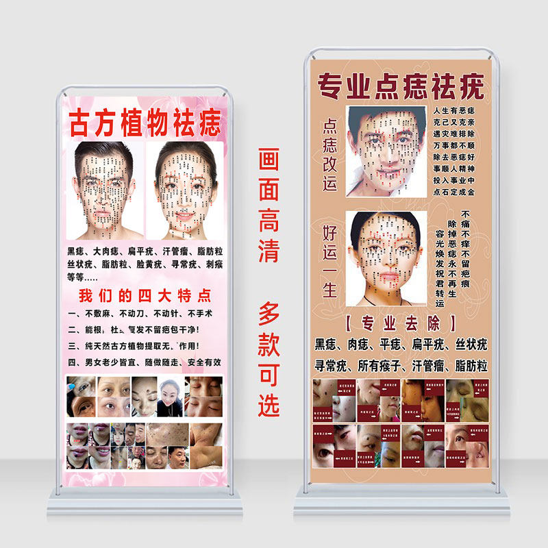 点痣图展架广告画古方祛疣宣传图面部面相风水挂图男女面痣图去痣