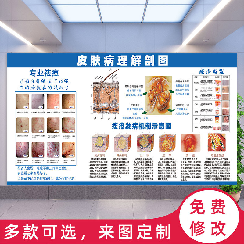 皮肤病理解剖图祛皱祛疤斑痘敏