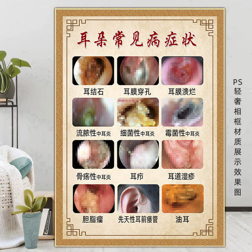 采耳洗眼海报耳朵常见病症广告画