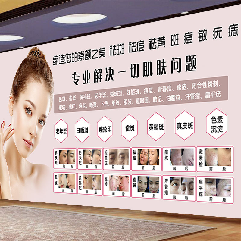 祛斑祛痘海报祛痣皮肤管理挂画