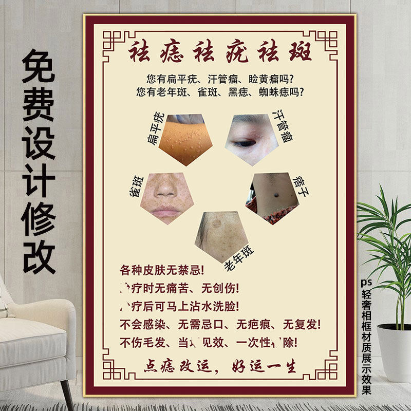祛痣祛疣海报宣传挂画丝状疣皮赘图片专业点痣祛斑广告男女面痣图