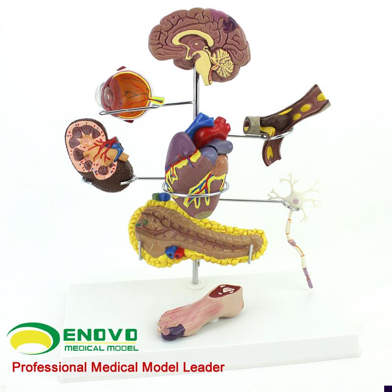 ENOVcO颐诺人体医学糖尿病模型并发症大脑心脏胰腺神经元足内外科