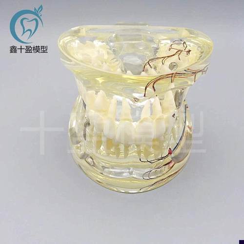 牙科水晶牙齿病g理模型M4019-2成人透明病理牙模型带牙神经和嵌体