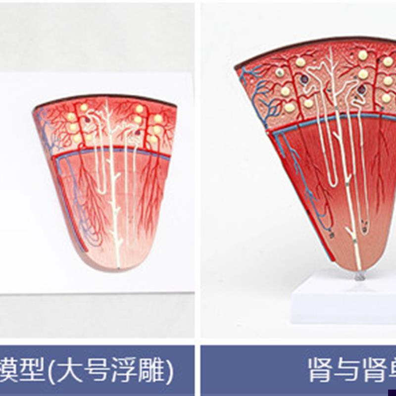 肾与肾单a位肾小球放大模型肾解剖模型人体肾脏模型内脏解剖