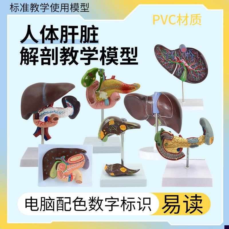 仿真人体肝脏模型肝解剖肝胆胰脾十二指肠病变肝胆U胰肝胆胰胃切