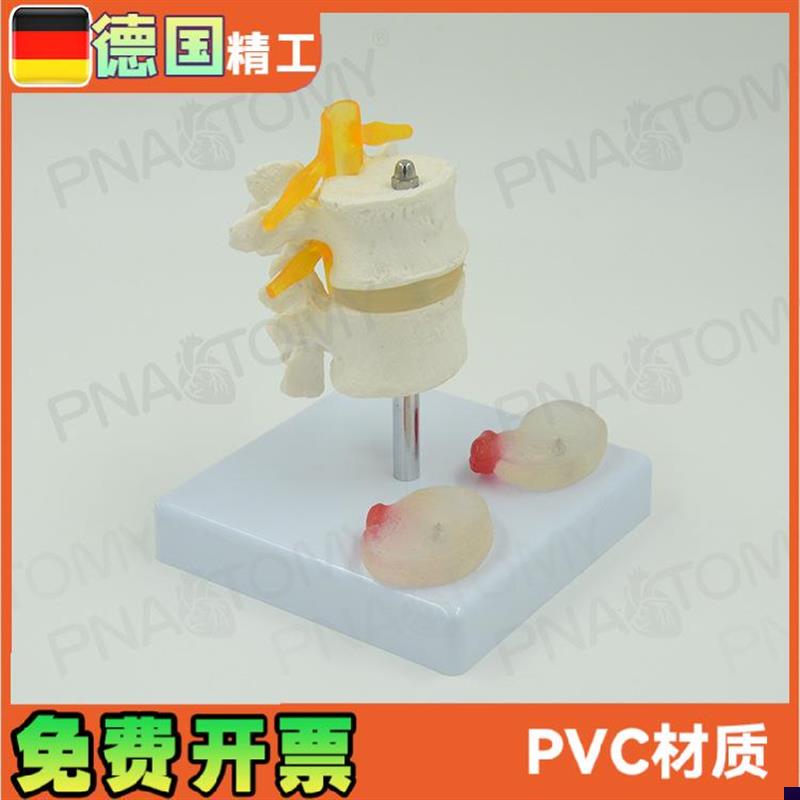 德国】人体腰椎盘突出模型两节腰椎骨骼骨科推拿演示教.学医学模