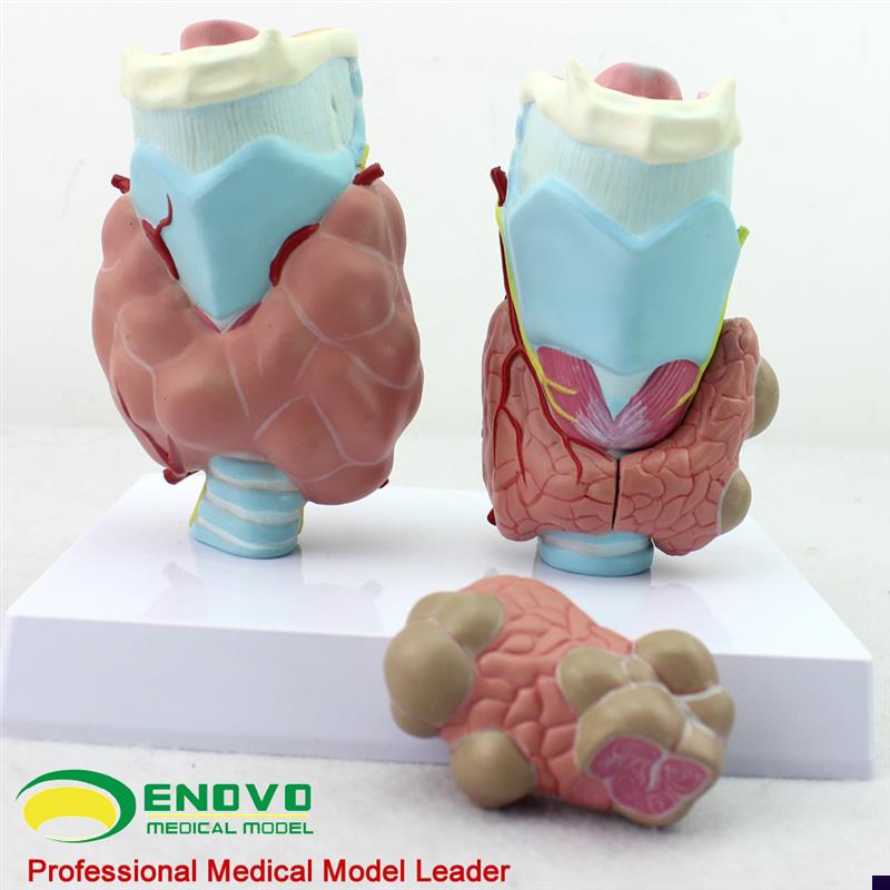 ENOVO正品人体甲状腺病理模型甲亢甲低甲减内分泌X系统医学解剖