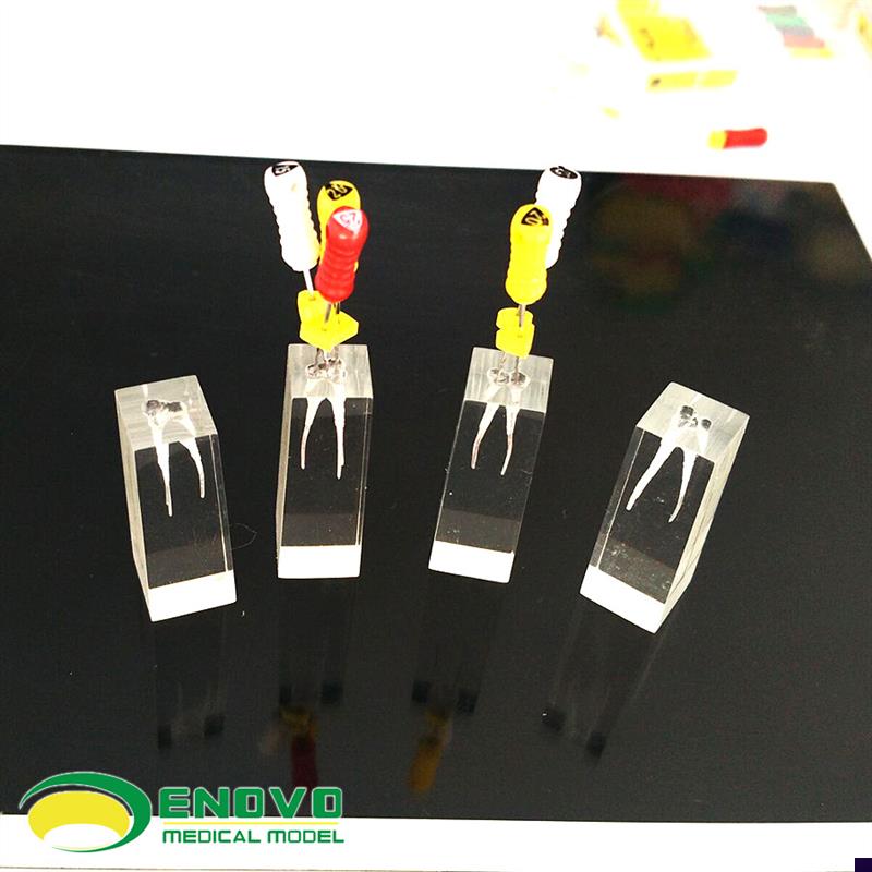 ENOVO正品牙体牙髓教学实践模型根管练习预备充填练习RXCT口外操