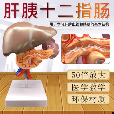 肝胰十二指肠模型肝脏模型胆囊模胰腺模型消化S系统病理胰脾肝胆