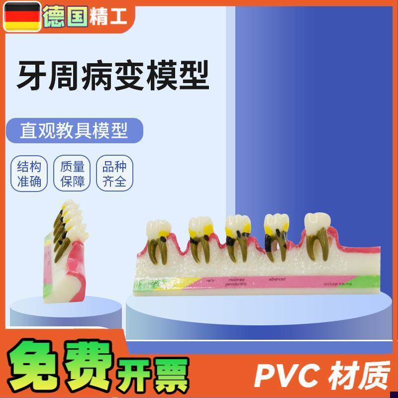 德国】PNT-OR13树脂成人牙周病变牙齿N模型口腔牙科教学摆件