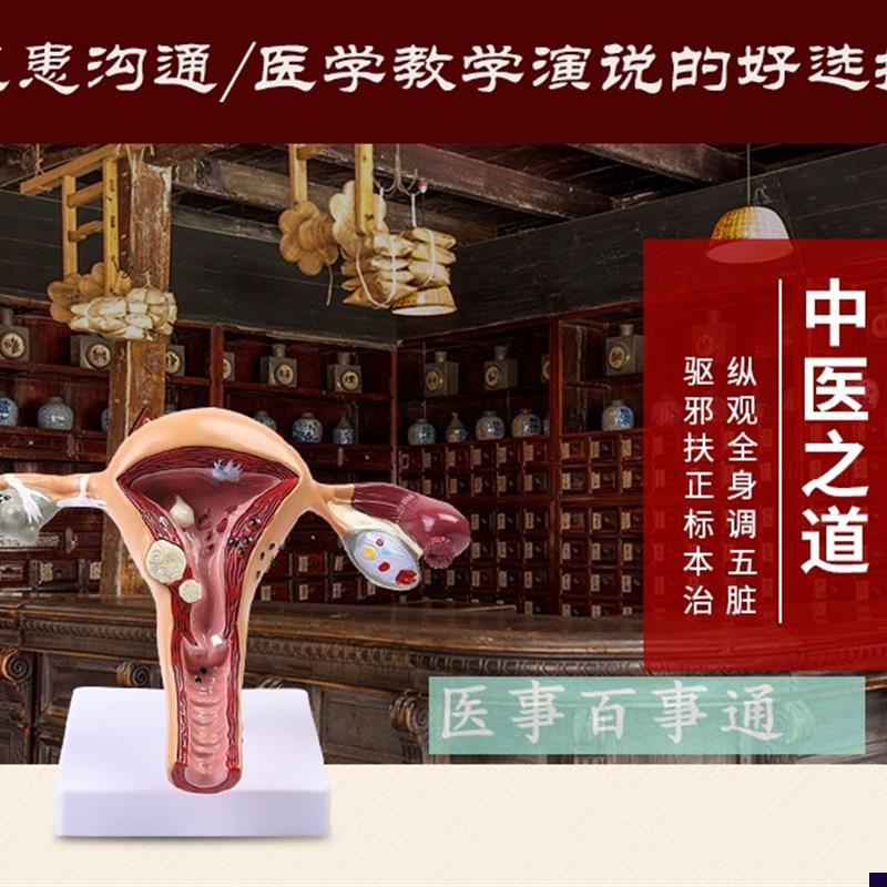人体子宫解剖模型子宫模型子宫癌变输卵管狭窄综合X疾病科普教育