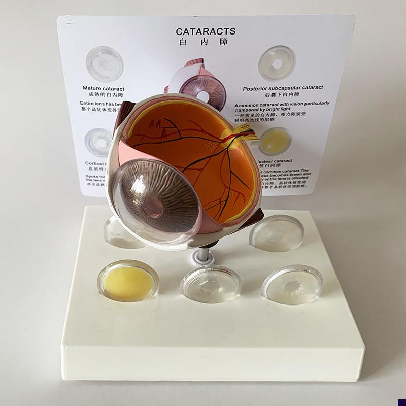 白内障眼b睛模型晶片虹膜器官解剖光学教仪医用医学教学教具包邮
