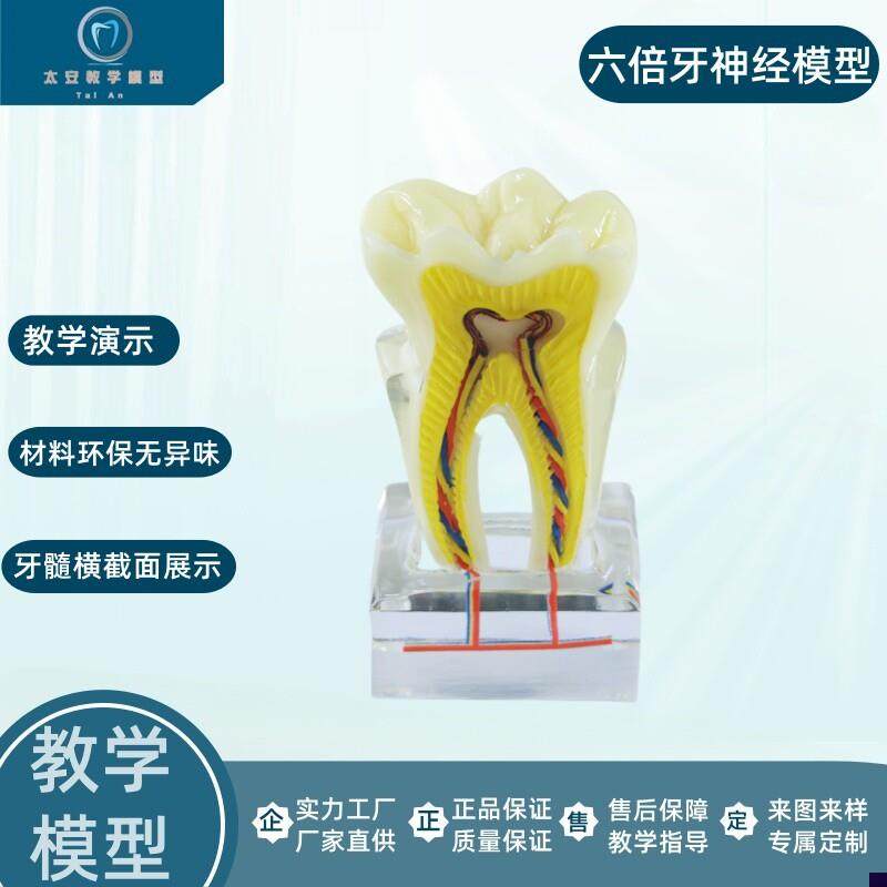 六倍龋齿模型牙齿模m型牙科模型右后牙组织分解模型六倍神经对比