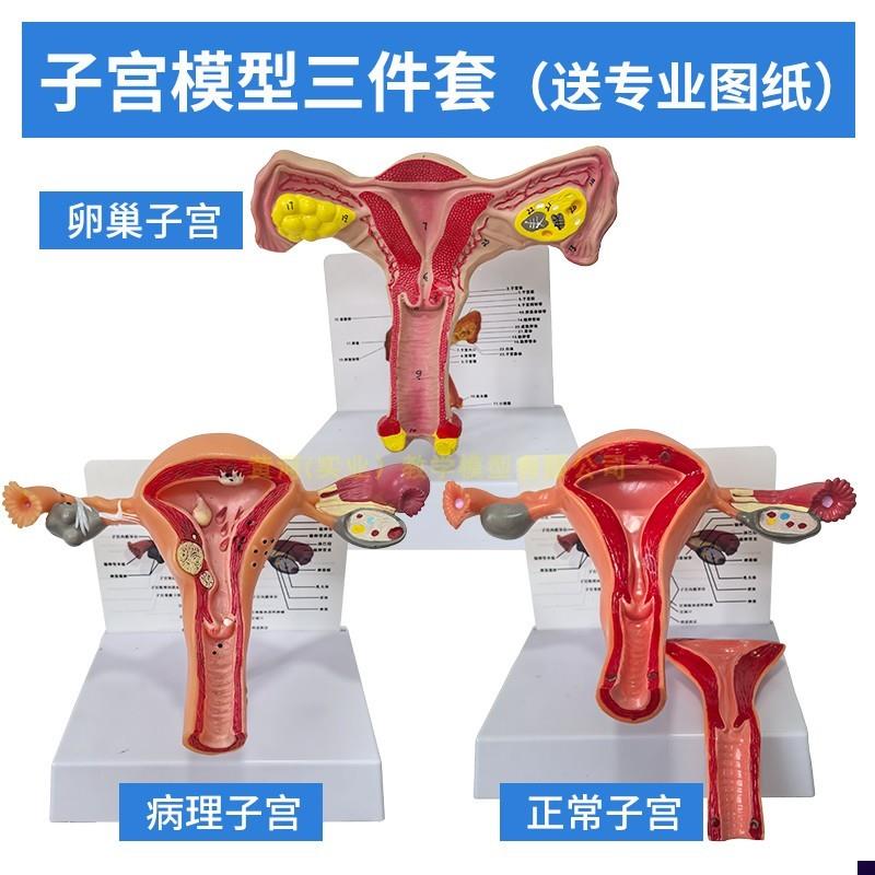 人体模型女性生殖子宫模型生殖卵巢模型教学模具病理X变化科学教