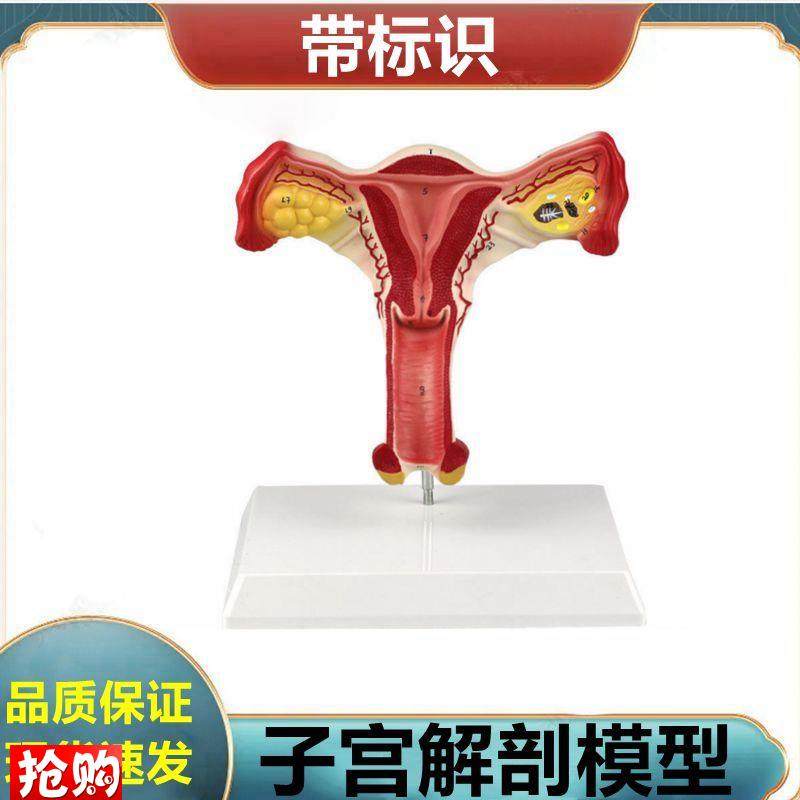 子宫解剖模型女生l殖器解剖可拆卸盆底肌肛周肌肉泌尿道膀胱妇科