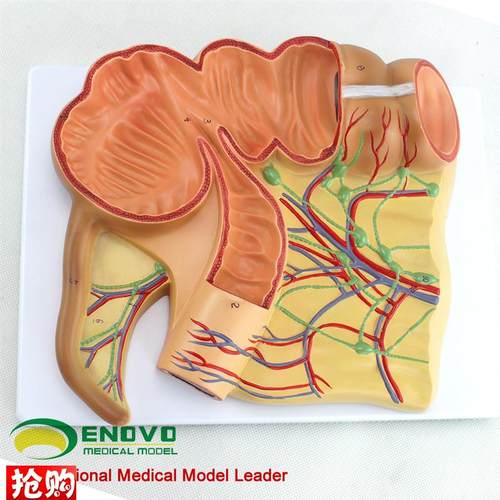 ENOVO颐诺人体医学回盲部解剖模D型盲肠阑尾升结回肠血管淋巴模型