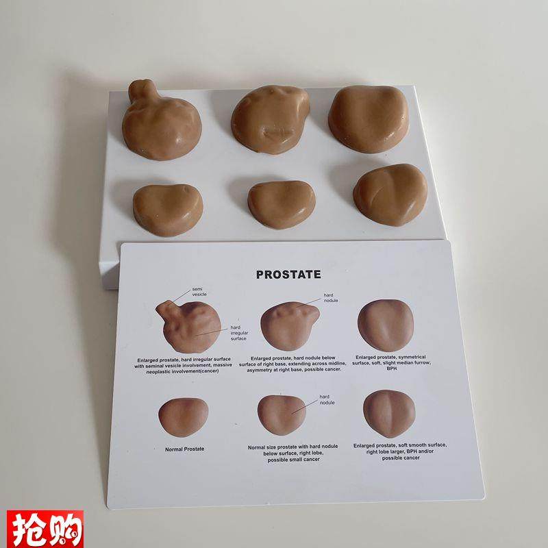 前列腺触诊练习临床辅检健康与病变指F检男科生殖医患沟通医药促