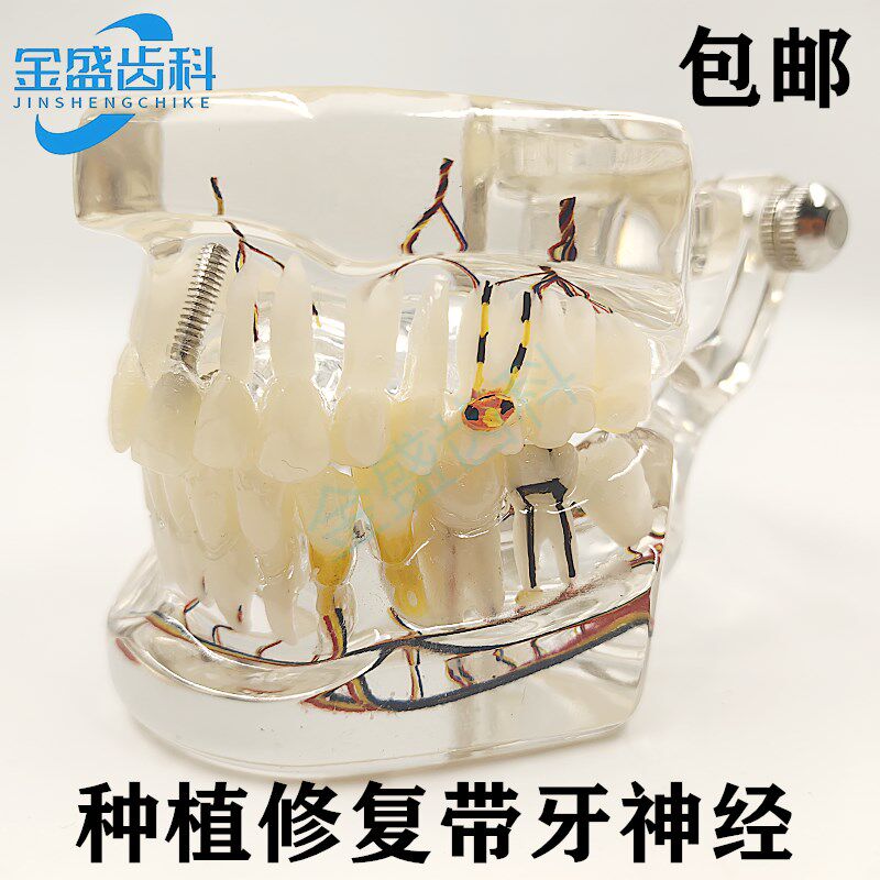 牙科口腔教学模型种植修复体牙模型种植带牙神经模型W医患沟通展