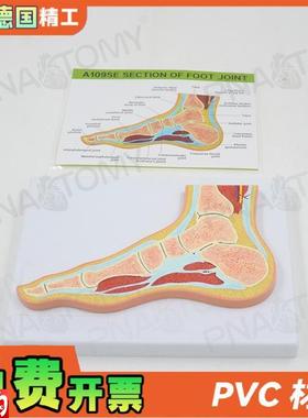 德国人体aMRI脚关节骨骼肌肉剖面构造解剖模型医学骨科疼痛科教学