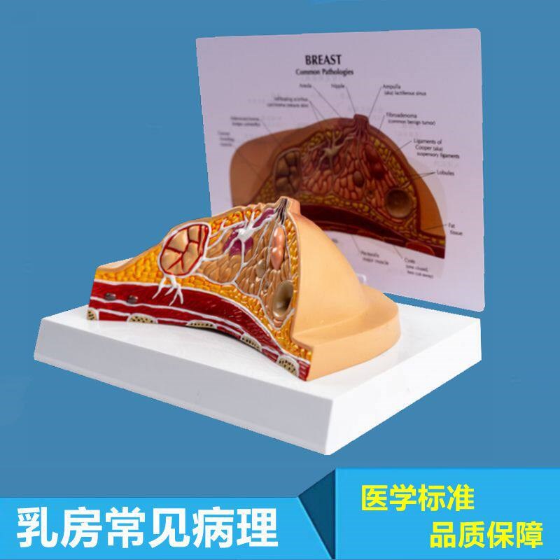 病理乳房模型乳腺结构哺乳期静止女C性生殖月嫂培训产康家政技校