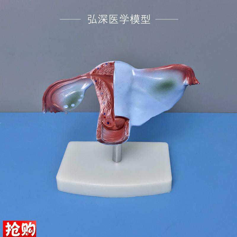 女性子宫模型人体生殖系统器官解剖卵巢输卵管Q妇产科医学教学模