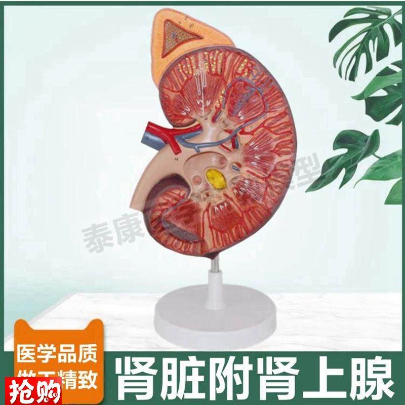 人体肾脏模型肾上腺放大审单位肾小球蛋J白尿形成尿液泌尿器官病