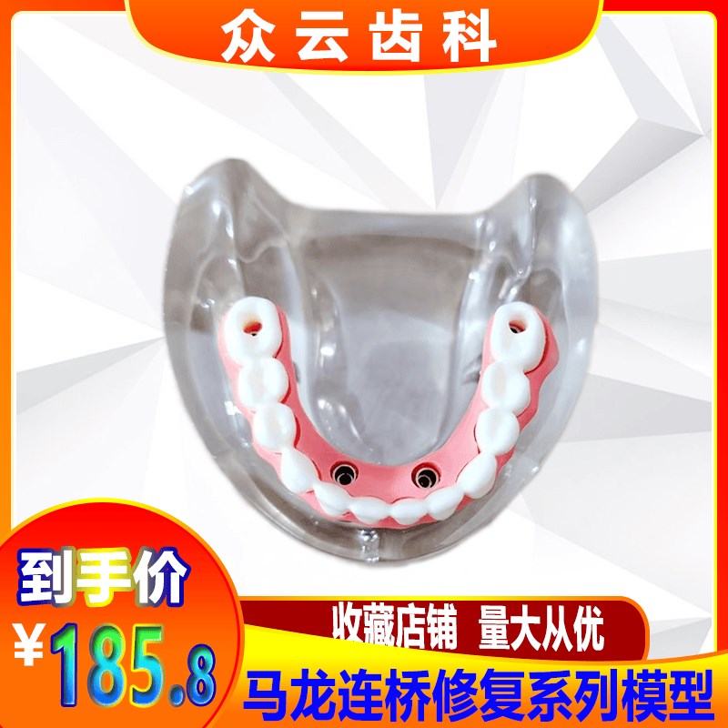 牙科模型b马龙连桥义齿修复种植牙齿仿真演示模拟教学医患交流包