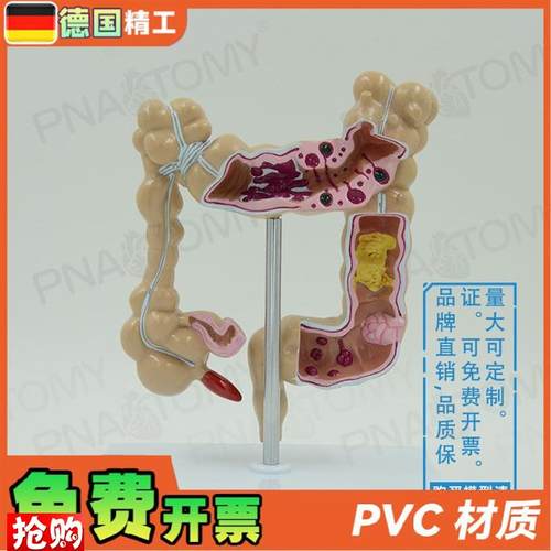 德国】仿真人体结肠大肠解剖模型肛肠科肠道肠胃W消化系统教学