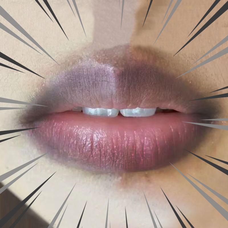 嘴角发黑去除改善唇周黑嘴唇去唇暗沉淡化唇色去唇角边黑去黑色素