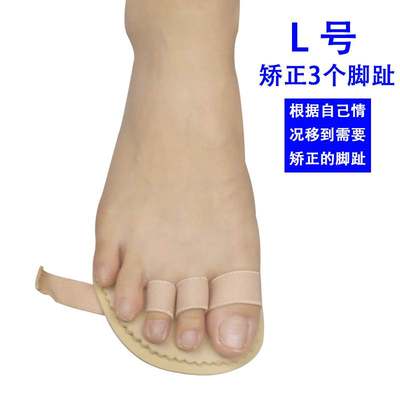 专业脚趾弯曲矫正器槌状趾锤状指弓形爪型趾头变形重叠抓地疼痛纠