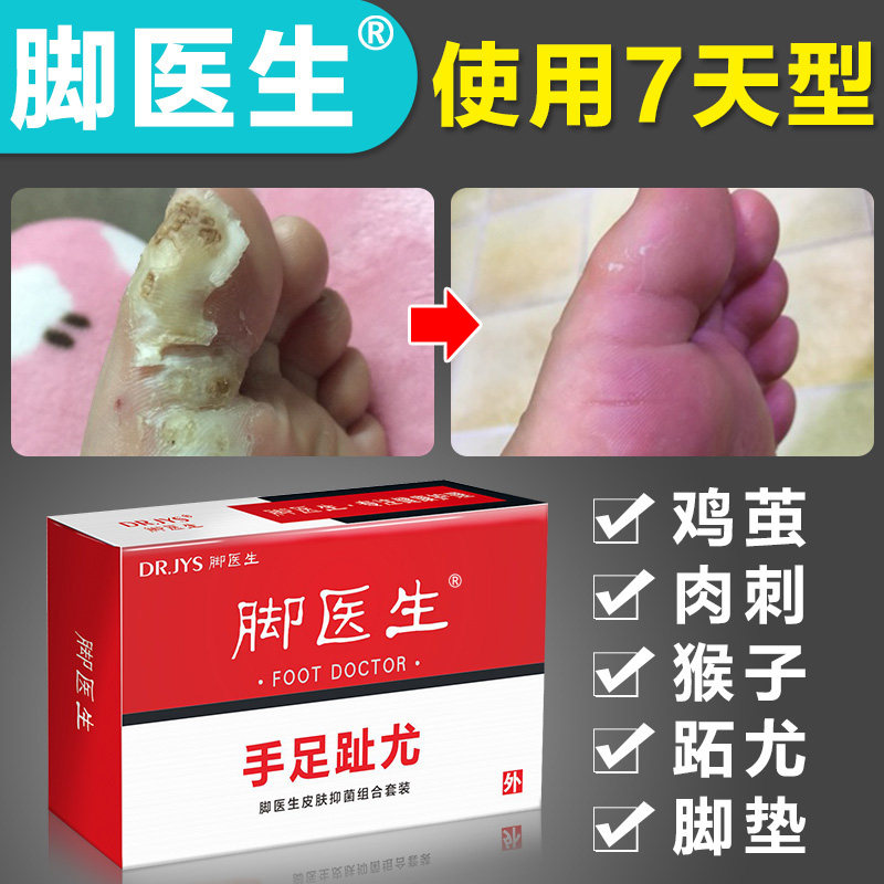 ??脚医生跖疣膏去除足部日本病毒寻常疣趾扁平疣瘊子立净去疣灵